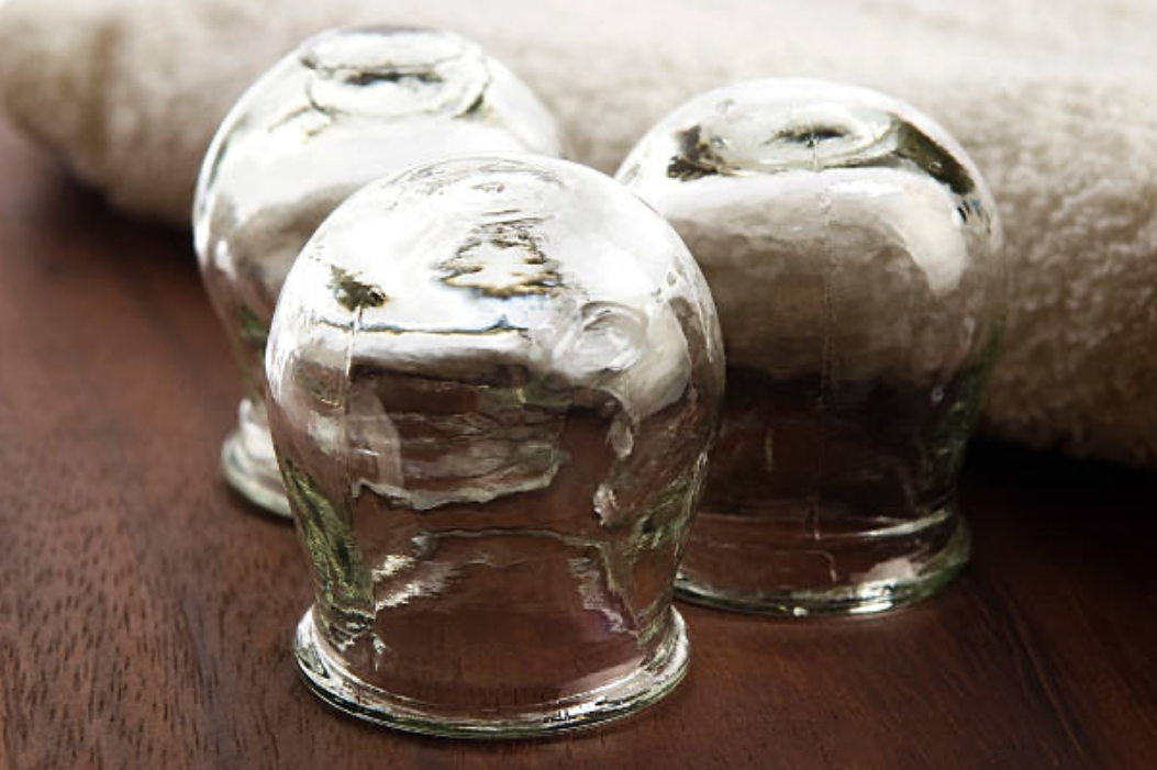 Ventouses utilisées dans un protocole de massage Tuina minceur